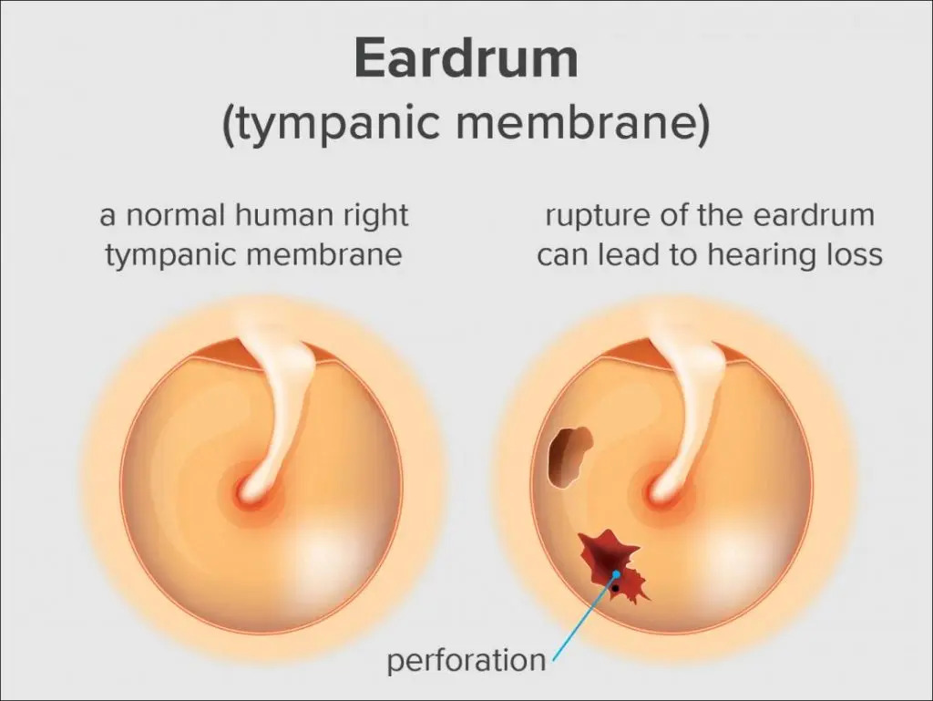 What is The Eardrum?